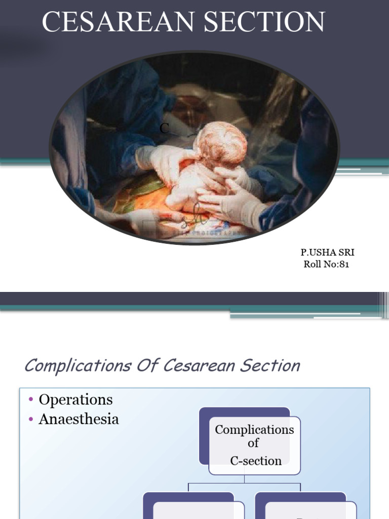 C Section Presentation | PDF