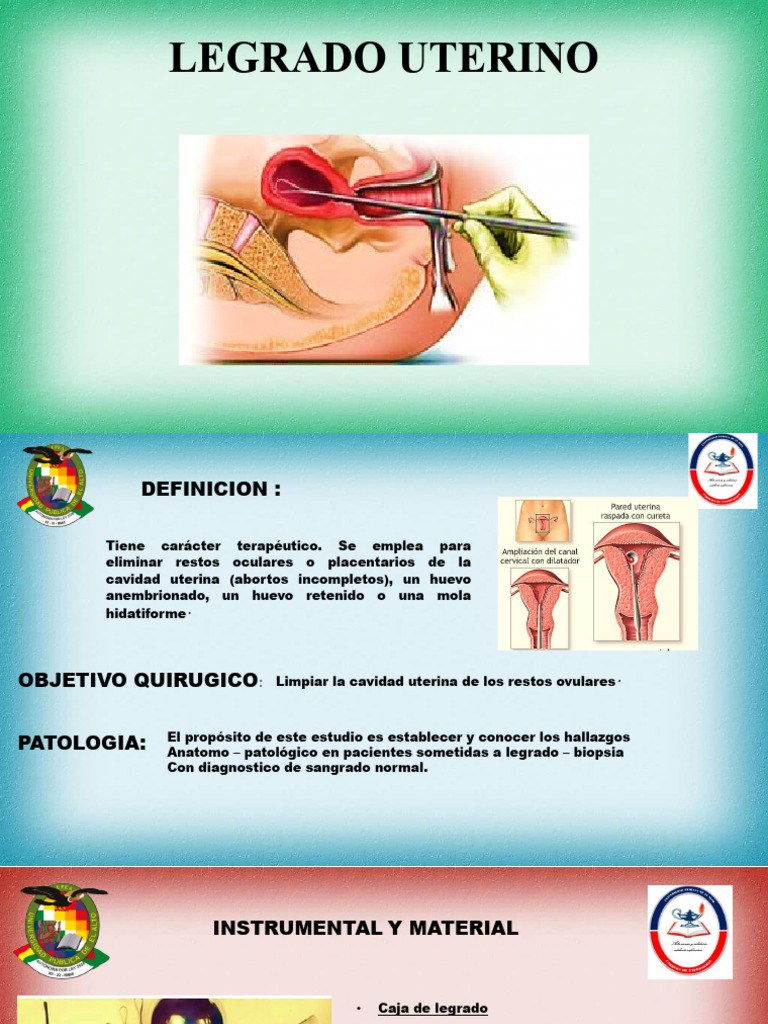 Legrado Uterino: Procedimiento y Materiales | PDF