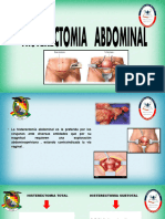 Histerectomia Abdominal