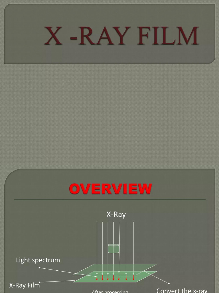 X Ray Film | PDF