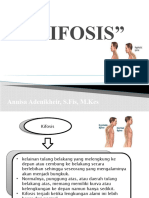 Kifosis