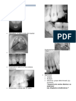 Anomalias Dentaria - Clase Imagen