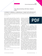 17 Lupus Panniculitis of The Scalp Presenting With Linear Alopecia Along The Lines of Blaschko