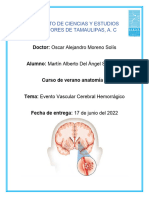 Evento Vascular Cerebral Hemorrágico