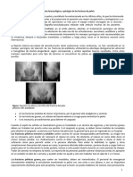 Tratamiento y Rehabilitacion Fractura de Pelvis