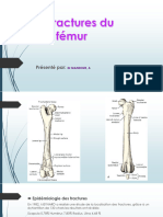 Fractures Femur