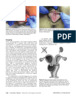 Management of Acute Obstructive Uterovaginal Anomalies (1) (4-6)