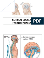 Hydrocephalus