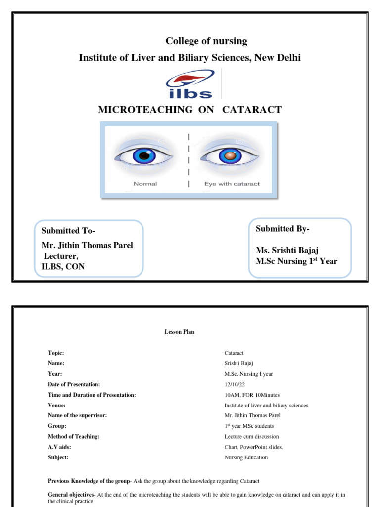 Cataract Final Lesson Plan Pdf