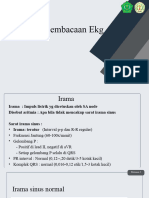 7 Langkah Pembacaan Ekg