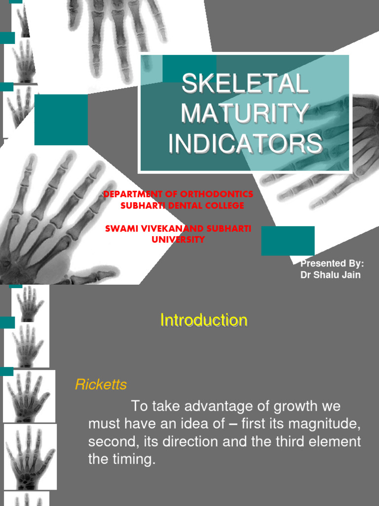 Skeletal Maturity Indicators Overview | PDF | Hand | Vertebra