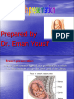 Breech & Shoulder Dystocia