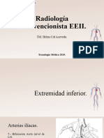 Radiología Intervencionista EEII y TVP