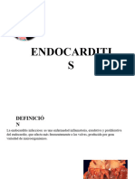 Endocarditis