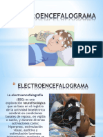 Actividad 3 Electroencefalograma