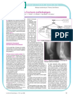 Fractures Pathologiques