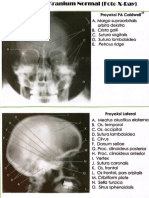 Radioanatomi Cranium