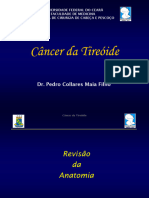 Cancer Da Tireoide DR Pedro