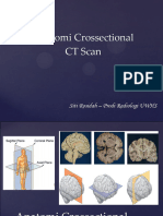 Anatomi Crossectional CT Scan Non Kontras