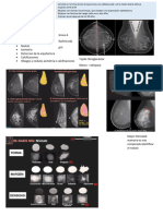 Mastografia Mama