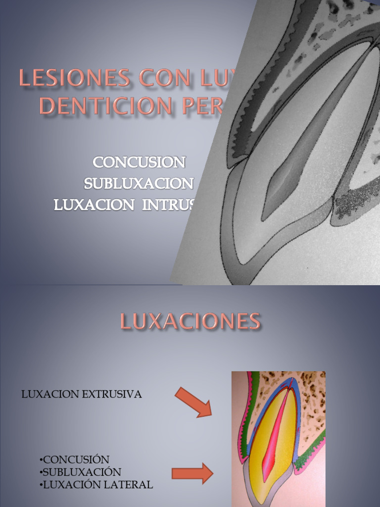 Concusion-Sublux-Lux Intru 2023 | PDF | Diente | Especialidades Medicas