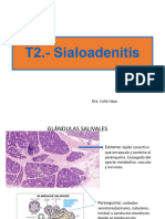 T2.-Sialoadenitis: Dra. Celia Haya