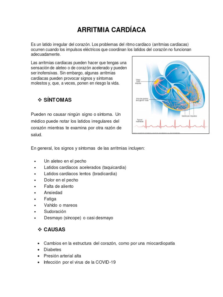 Arritmia Cardíaca: Síntomas y Prevención | PDF