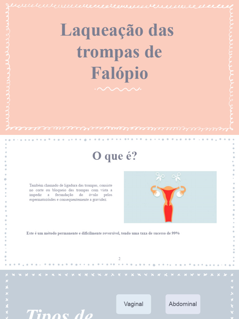 Laqueação Das Trompas | PDF | Gravidez | Reprodução humana