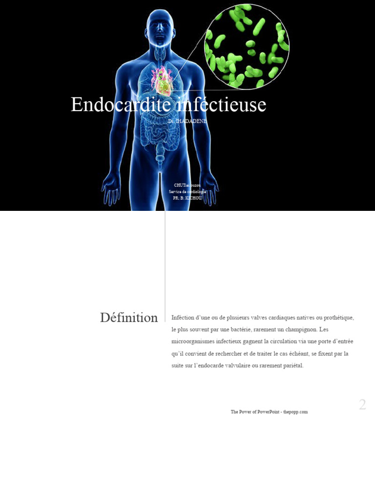 Comprendre l'endocardite infectieuse | PDF | Sciences et mathématiques