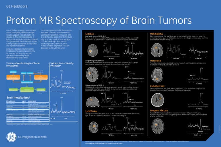 Brain Tumor MRS Poster | PDF | Brain Tumor | Clinical Medicine