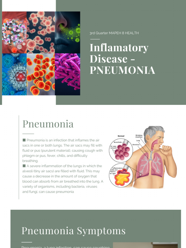 Pneumonia 20240306 064300 0000 | PDF