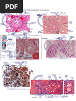 Escala de NISH | PDF | Afasia | Neurología