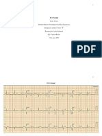 Ecg Normal JF