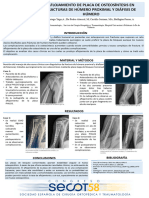 Introducción: Aflojamiento de Placa de Osteosíntesis en Fracturas de Húmero Proximal Y Diáfisis de Húmero