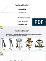 Traction Fixation