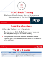 ISUOG Basic Training: Distinguishing Between Normal & Abnormal Appearances of The Skull & Brain