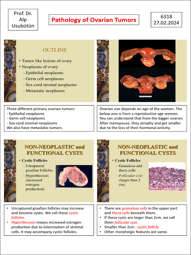 Pathology of Ovarian Tumors Overview | PDF | Wellness | Science ...
