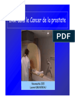 IRM Prostate