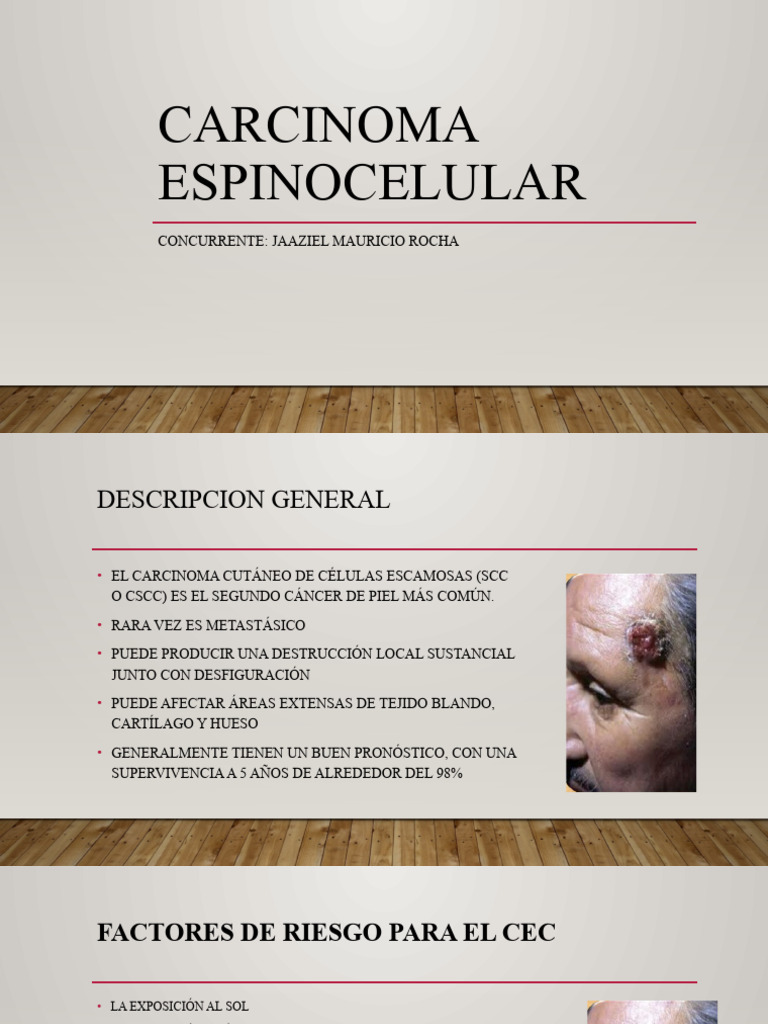 Carcinoma Espinocelular Diagnóstico Y Tratamiento Pdf Metástasis 
