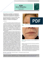 Sarcidosis en Zonas Infiltradas - Lopez - Pestana - 2011