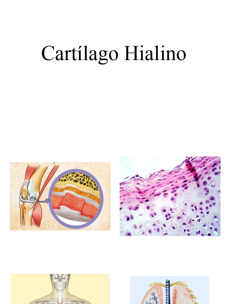Cartílago Hialino PDF