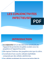 Les Conjonctivites Infectieuses