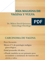 Patologia Maligna de Vagina y Vulva