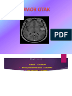 ppt tumor otak kelompok 8