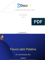 Diapositiva Labio Palatino y Fisura Labial