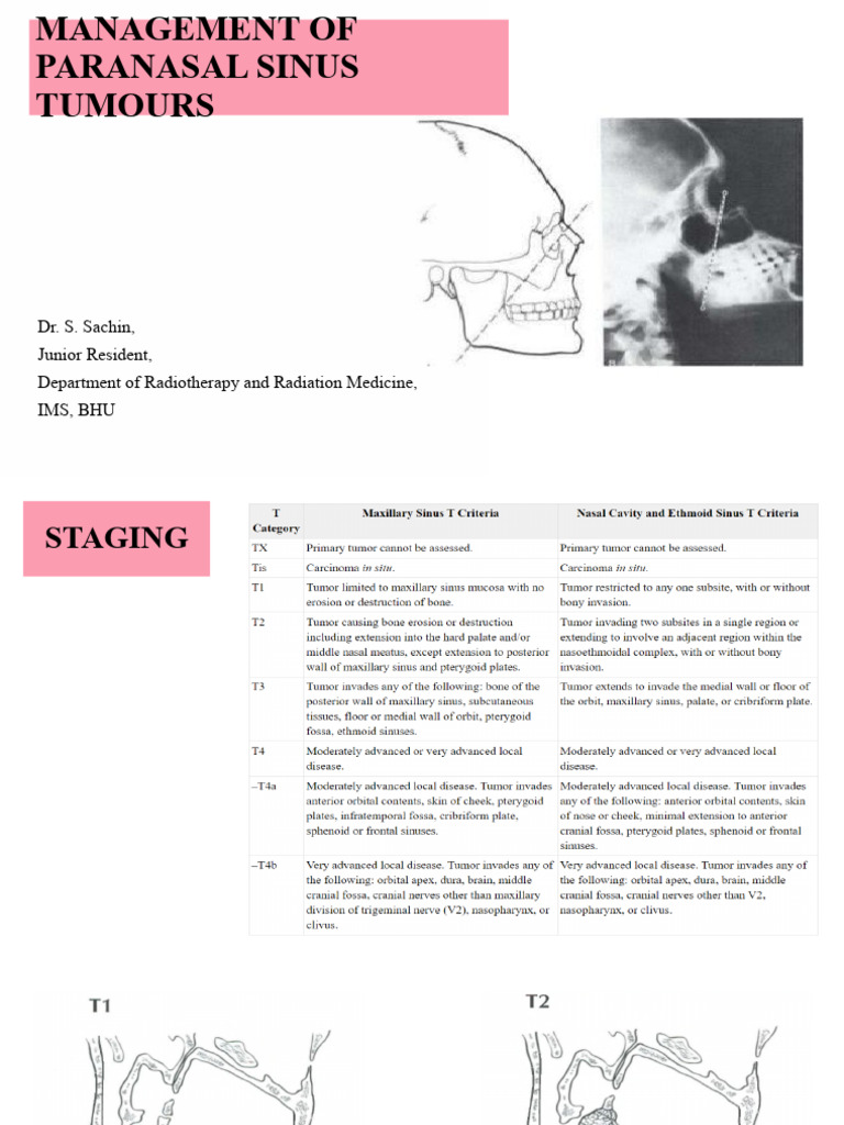Paranasal Sinus Tumours Management | PDF | Neck | Radiation Therapy
