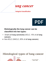Lung Cancer Classification