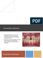 Anomalias Geneticas