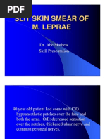 Download Slit Skin Smear for m by api-3823785 SN7123300 doc pdf