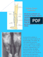 Zwiebel Ultrasonografia Vascular